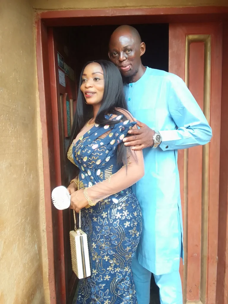 I promise to cherish, support and adore you forever - Nigerian lady writes as she shares wedding introduction photos with her burn survivor fiancé