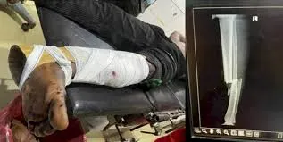 FCT Police Launch Probe into Alleged Shooting of 21-Year-Old Student by Bribe-Seeking Officers