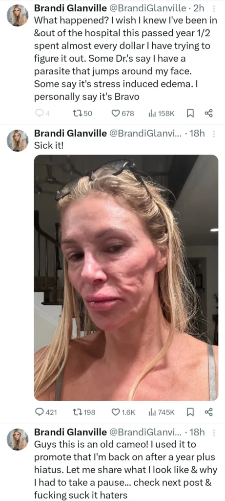 Brandi Glanville Reveals Health Struggles in Shocking Face Photo