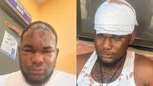 Autopsy Findings: The Tragic Death of Okediachi Emeka Linked to Hypertensive Heart Disease and Substance Abuse