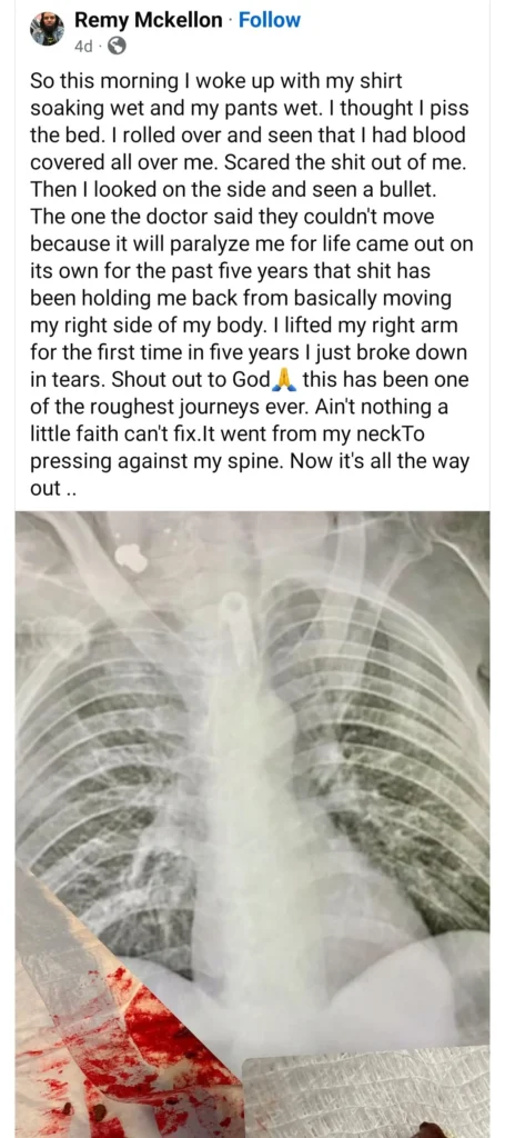 Incredible Survival Story: Man's Faith Leads to Miraculous Bullet Removal