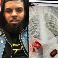 Incredible Survival Story: Man's Faith Leads to Miraculous Bullet Removal