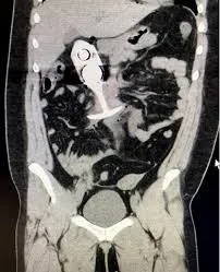 Medical Experts Warn: Never Bring S£x Toys to MRI Appointments