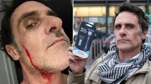 Shaving Mishap Leads to £5000 Compensation: Understanding Your Rights