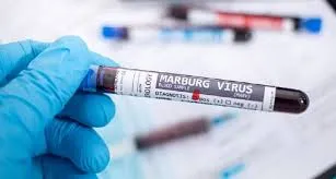 Tanzania Marburg Outbreak: Death Toll Increases to Nine - Latest Updates