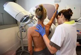 The Gender Divide in Cancer: Investigating the 82 Percent Higher Rates in Young Women Relative to Men