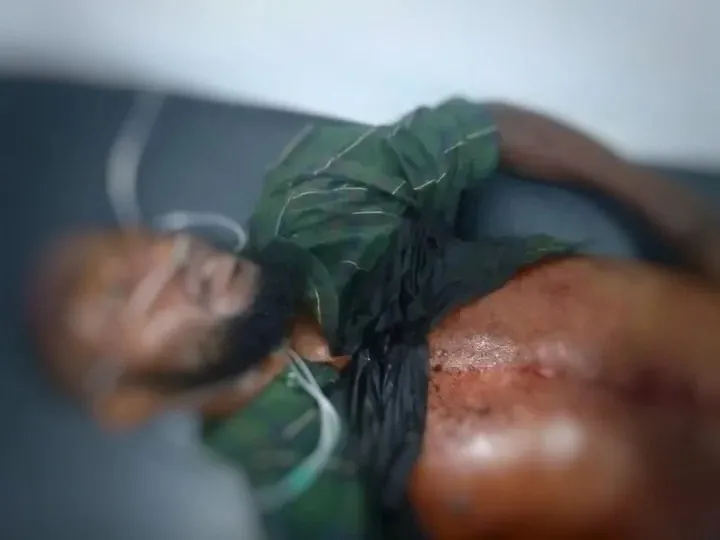 Tragic Incident: Young Man Stabbed to Death by Phone Snatchers in Jos